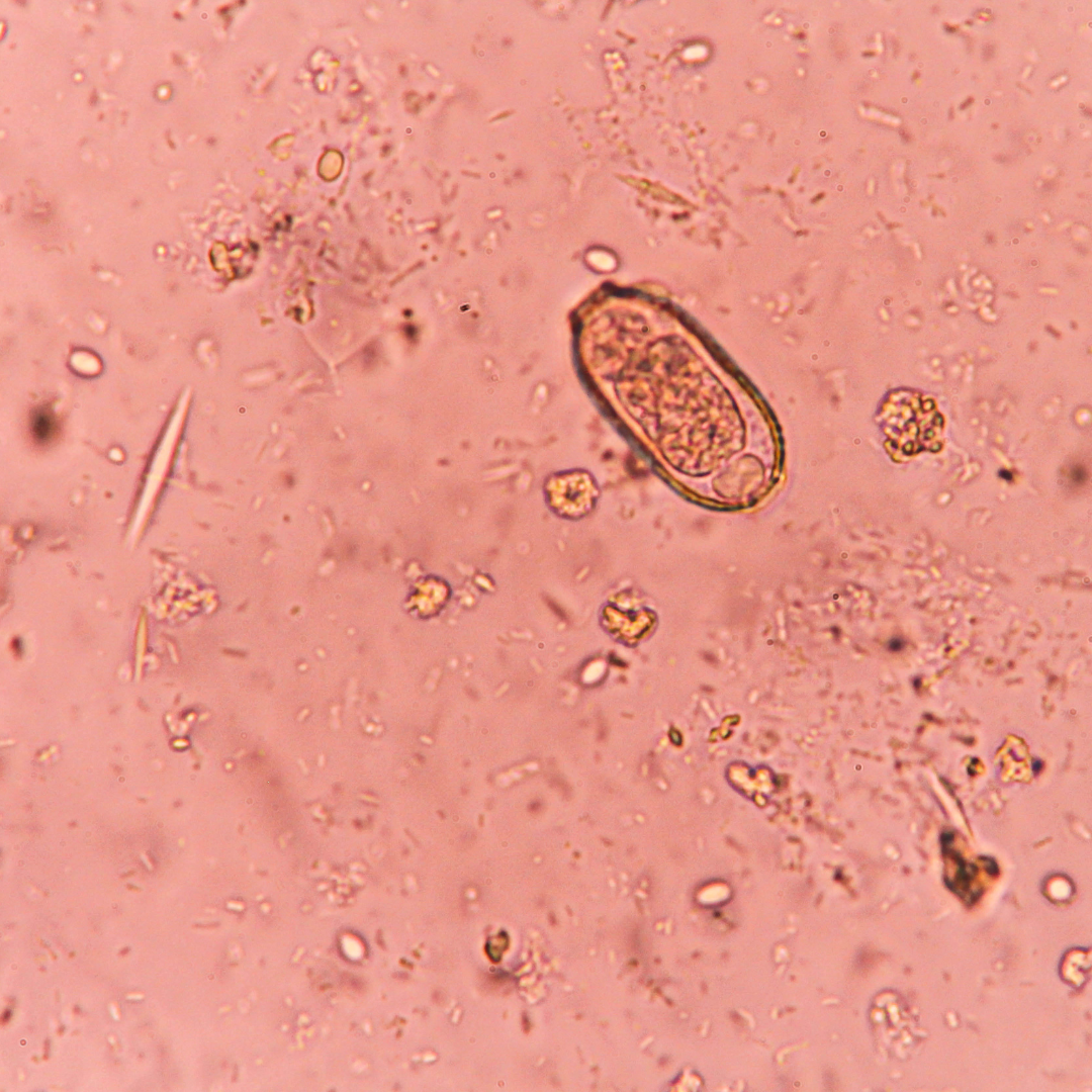 Blastocystis hominis Intestinal Parasite